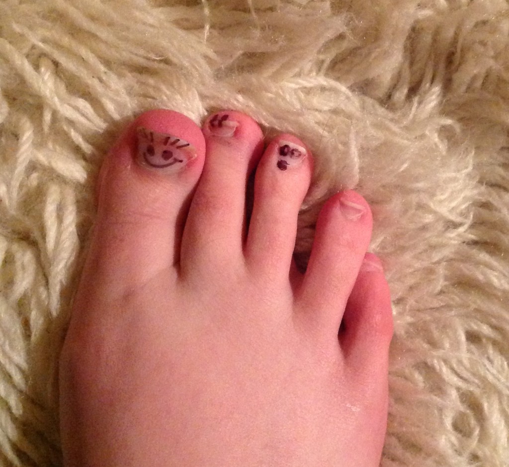 Middle Toe is shocked by the development of smiley faces on toughened keratin that sits on top of distal phalanges.